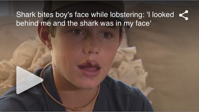 Boy Bitten In Face By Shark Off Florida Coast While Lobstering ...